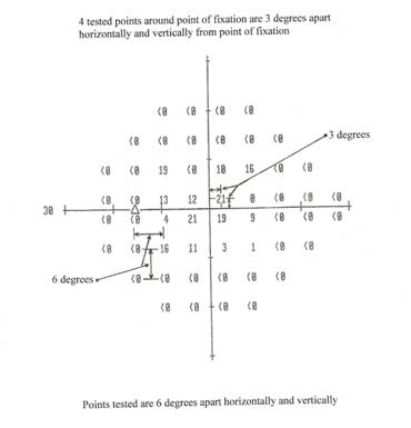 HFA 24-2 dB printout for the left eye, showing X and Y axis,
      four tested points around point of fixation are 3 degrees apart
      horizonatally and vertically from point of fixation