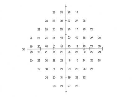 HFA 30-2 dB printout for the right eye