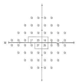 Eye chart showing creation of pseudoisopter