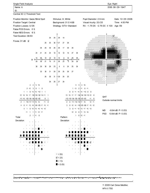 Visual Field Test Chart