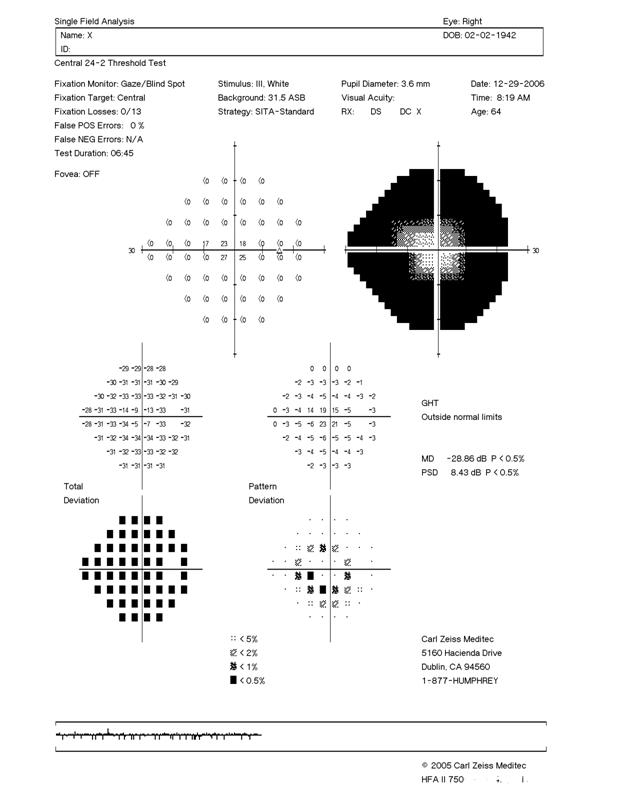 Visual Field Defects Chart