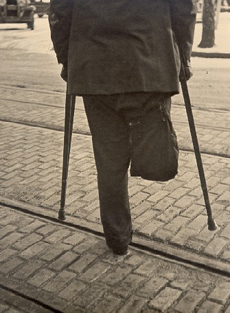 man on crutches